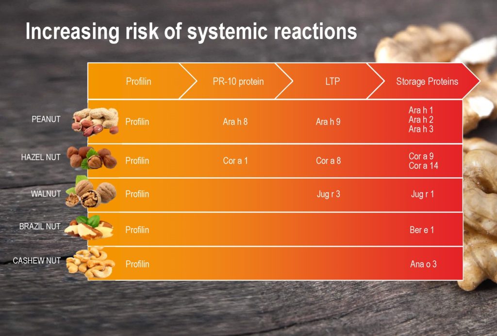 Food Allergy Testing Food Allergy Treatment Pediatric Allergist
